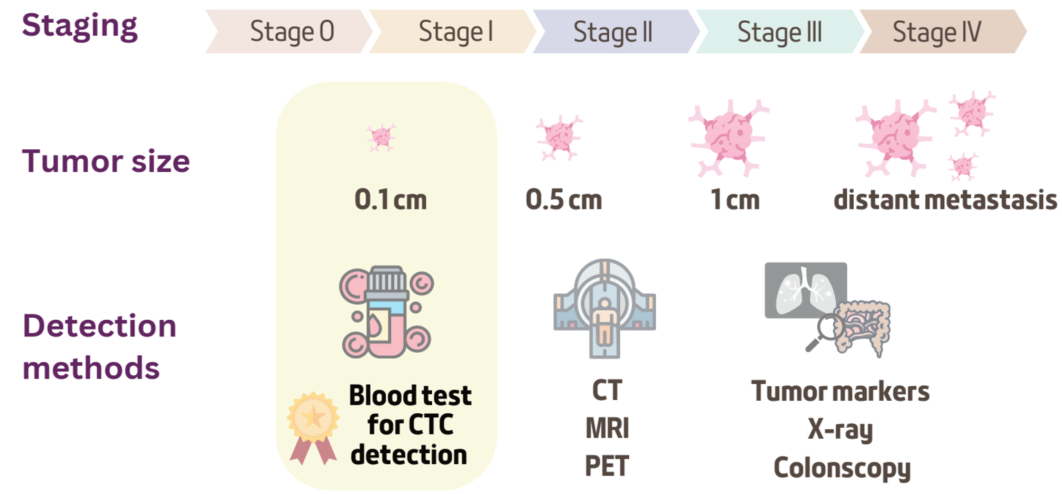 Cancer stage progression diagram